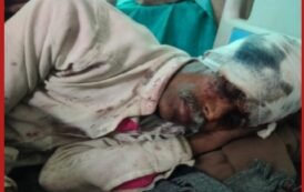 गोलीबारी से दहला मिसिरदोहर: जमीन विवाद में युवक को लगी गोली, अस्पताल में भर्ती